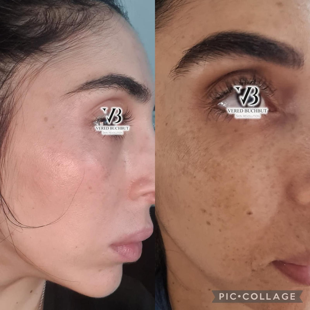 Whitening Kit Full Treatment